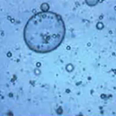 Emulsion(oil and water)