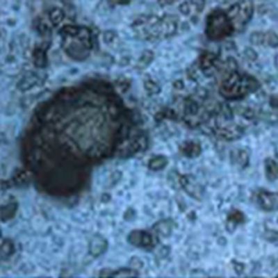 Emulsion(oil and water)